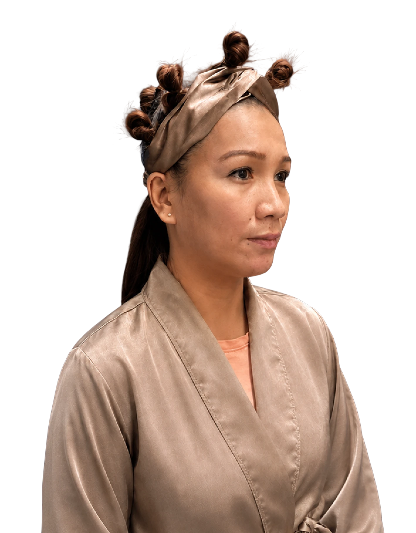 Client before their Aivee threadlift treatment